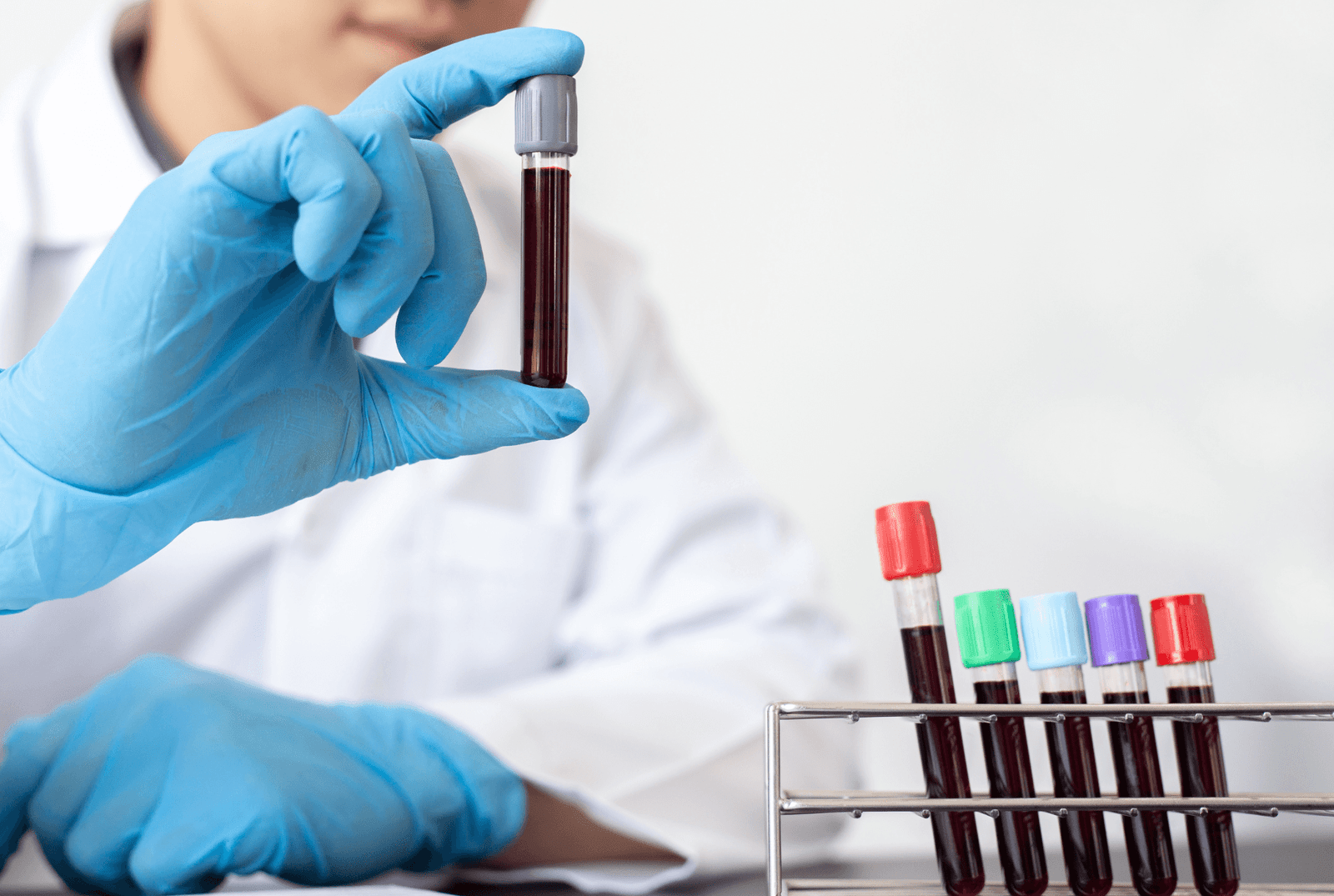 paternity test before pregnancy